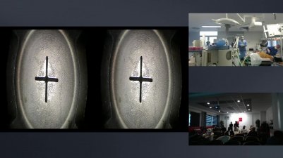 Masterclass Prostatectomie Robot 3D