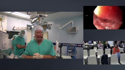 Transoral anti reflux therapy course - Session 1, surgery 1