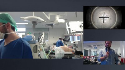 Masterclass Prostatectomie Robot 2D